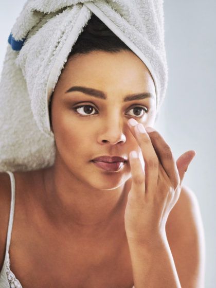 Von Creme bis Filler – so wirst du Krähenfüße für immer los!