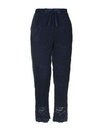 SoAllure BOTTOMWEAR - Pantaloni su YOOX.COM
