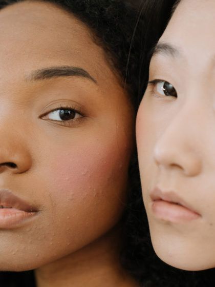 The best concealers for acne-prone skin