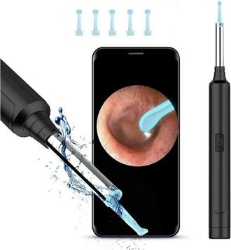 Trade Shop Trade Shop - Otoscopio Ispezione Orecchio Kit Rimozione Cerume Wifi Microscopio Camera Q-es1