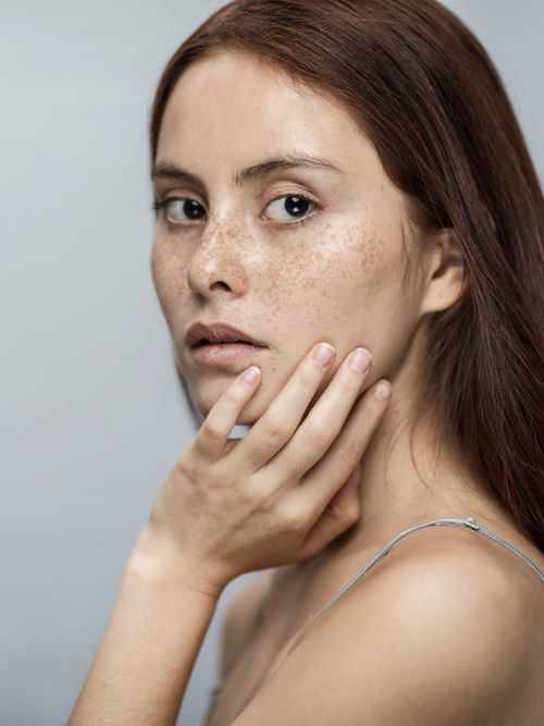 Eine Frau mit Sommersprossen greift sich ins Gesicht.