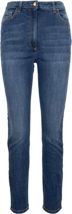 Elisabetta Franchi Zipper Button Jeans - Dames - Slim Fit Jeans - Blauw - W26 - Katoen - Jeans